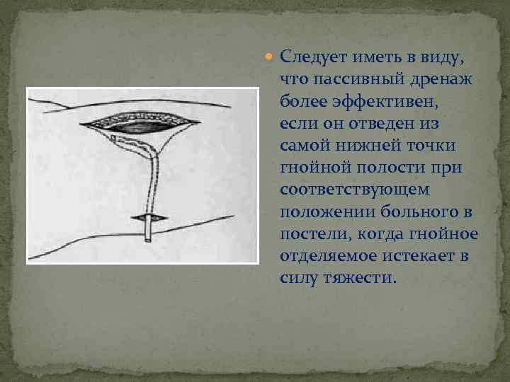  Следует иметь в виду, что пассивный дренаж более эффективен, если он отведен из