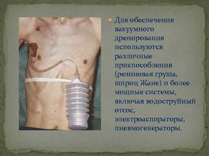  Для обеспечения вакуумного дренирования используются различные приспособления (резиновая груша, шприц Жане) и более