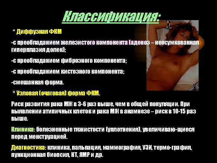 Классификация: ٭ Диффузная ФКМ -с преобладанием железистого компонента (аденоз – неосумкованная гиперплазия долек); -с