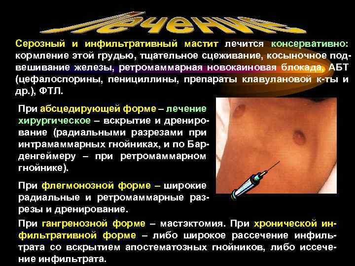 Серозный и инфильтративный мастит лечится консервативно: кормление этой грудью, тщательное сцеживание, косыночное подвешивание железы,