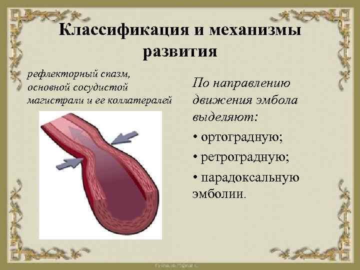 Классификация и механизмы развития рефлекторный спазм, основной сосудистой магистрали и ее коллатералей По направлению