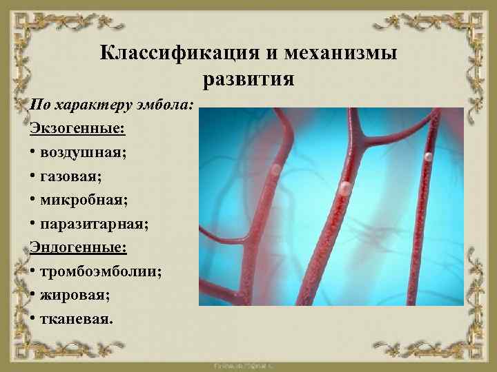 Классификация и механизмы развития По характеру эмбола: Экзогенные: • воздушная; • газовая; • микробная;