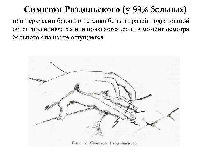 Разнообразие клинической картины при остром аппендиците связано с