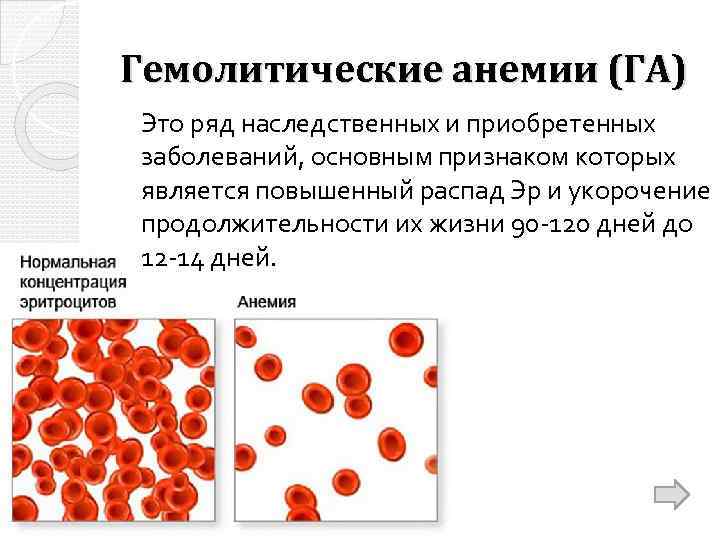 Гемолитические анемии (ГА) Это ряд наследственных и приобретенных заболеваний, основным признаком которых является повышенный