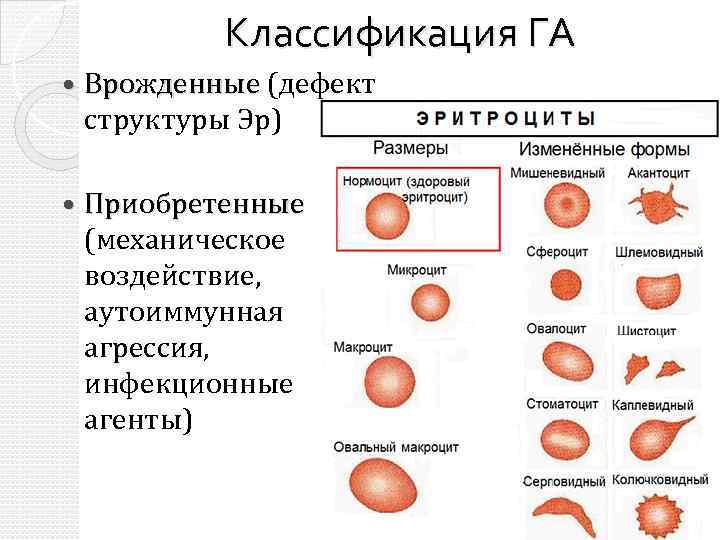 Классификация ГА Врожденные (дефект структуры Эр) Приобретенные (механическое воздействие, аутоиммунная агрессия, инфекционные агенты) 