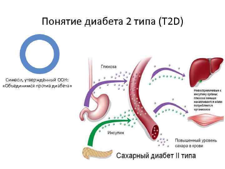 Понятие диабета 2 типа (T 2 D) Понятие диабета 2 типа ( Символ, утверждённый