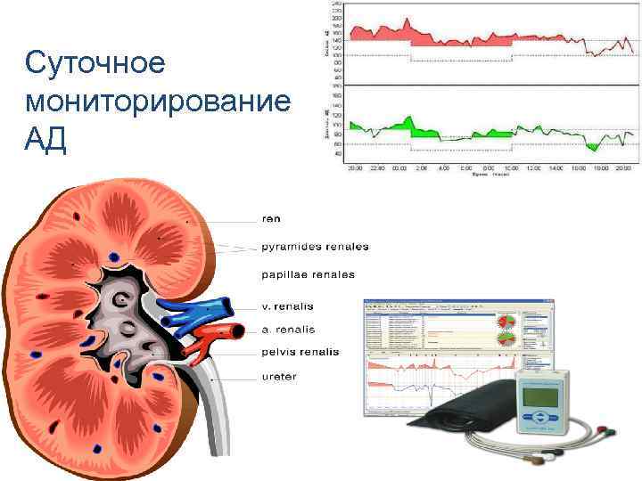 Суточное мониторирование АД 