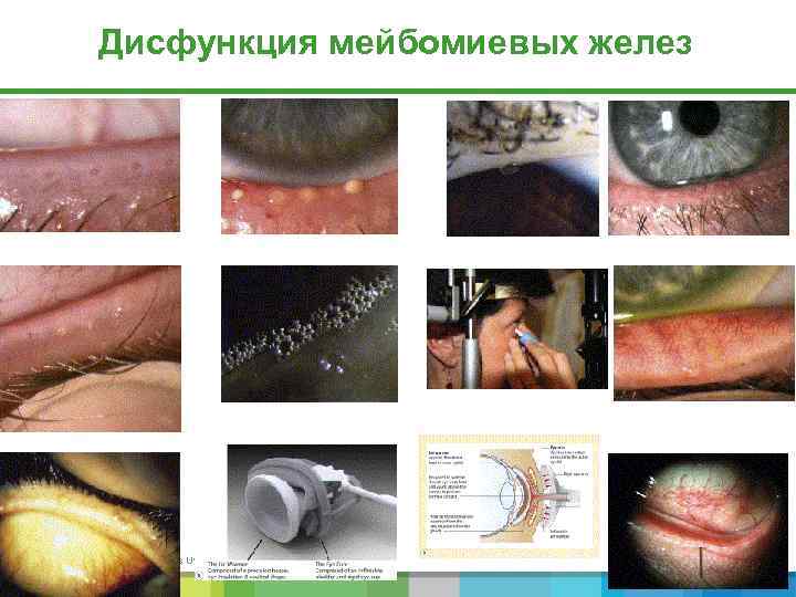 Дисфункция мейбомиевых желез 121 | Subject | Date | Business Use Only 