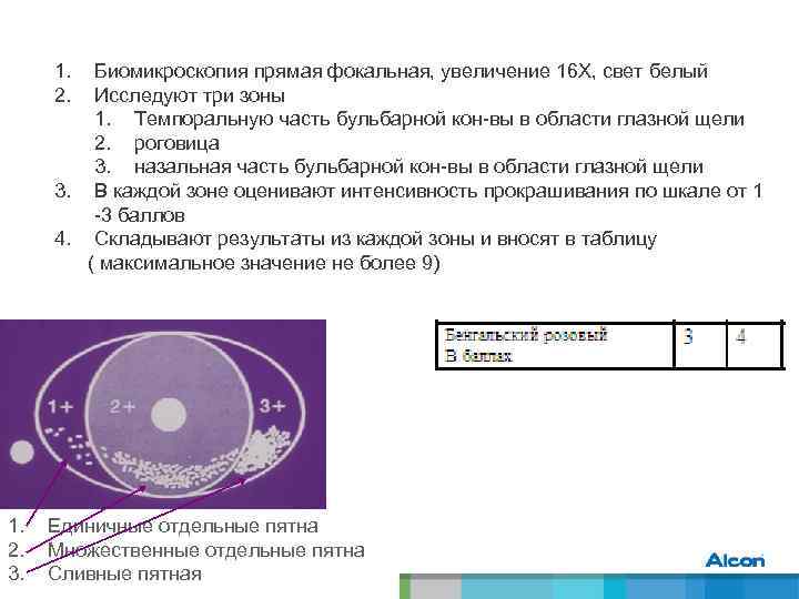 1. 2. Биомикроскопия прямая фокальная, увеличение 16 Х, свет белый Исследуют три зоны 1.