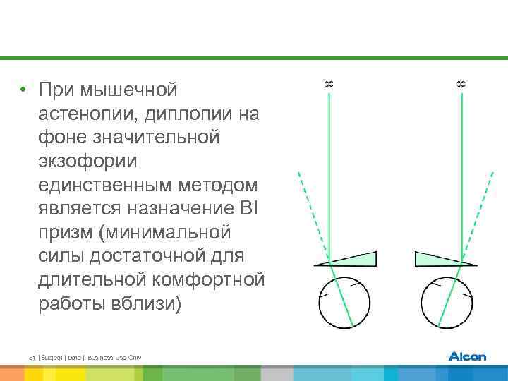  • При мышечной астенопии, диплопии на фоне значительной экзофории единственным методом является назначение