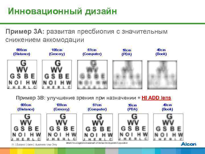 Инновационный дизайн Пример 3 A: развитая пресбиопия с значительным снижением аккомодации 600 cm (Distance)