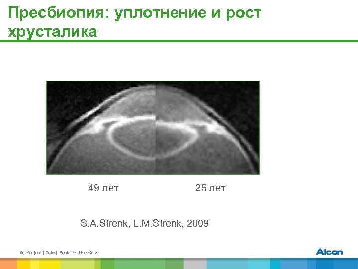 Пресбиопия: уплотнение и рост хрусталика 49 лет 25 лет S. A. Strenk, L. M.