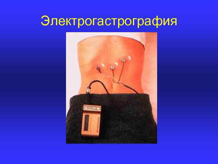 Электрогастрография 