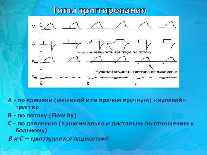 Типы триггирования A - по времени (машиной или врачом вручную) «нулевой» триггер B -