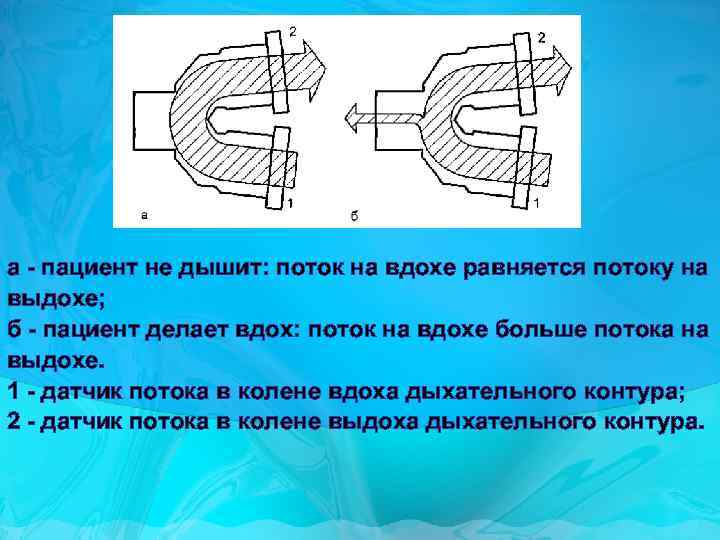 а - пациент не дышит: поток на вдохе равняется потоку на выдохе; б -