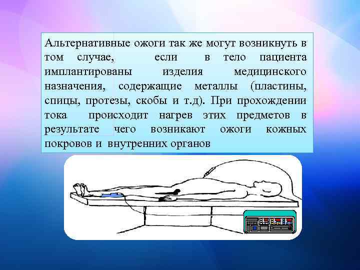 Альтернативные ожоги так же могут возникнуть в том случае, если в тело пациента имплантированы