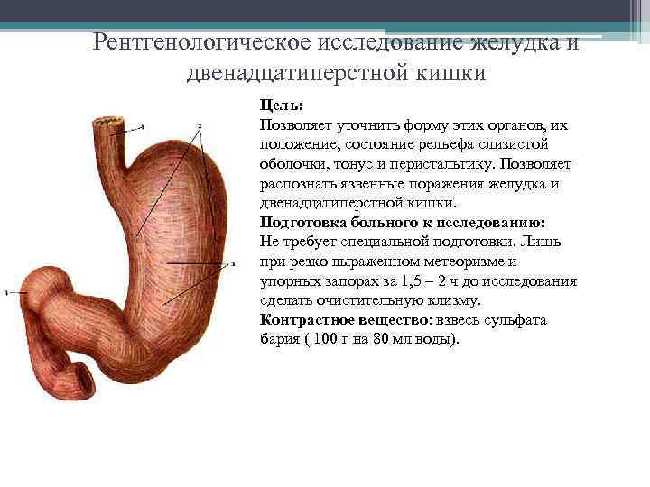 Рентгенологическое исследование желудка и двенадцатиперстной кишки Цель: Позволяет уточнить форму этих органов, их положение,