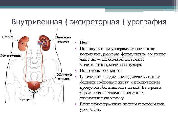 Внутривенная ( экскреторная ) урография • Цель: • По полученным урограммам оценивают положение, размеры,