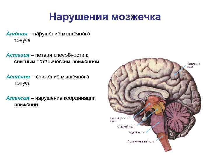 Нарушения мозжечка Атония – нарушение мышечного тонуса Астазия – потеря способности к слитным тетаническим