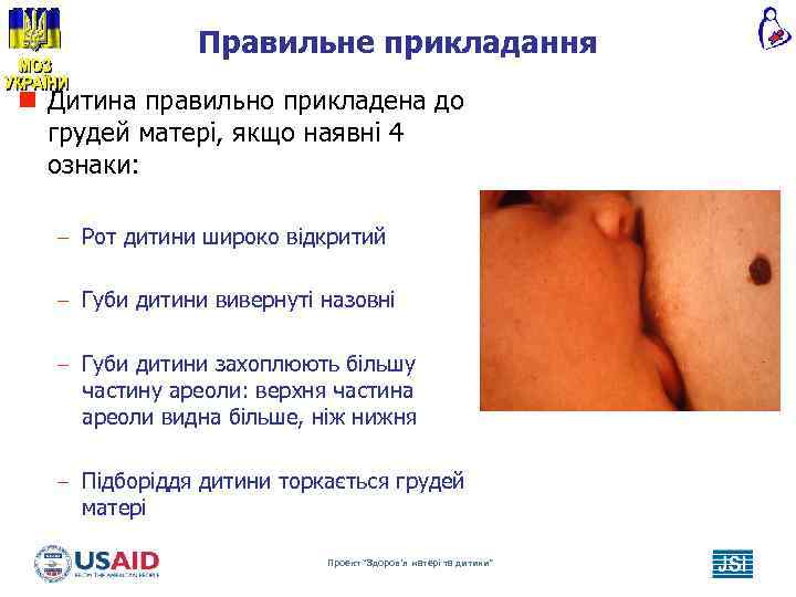 Правильне прикладання n Дитина правильно прикладена до грудей матері, якщо наявні 4 ознаки: –