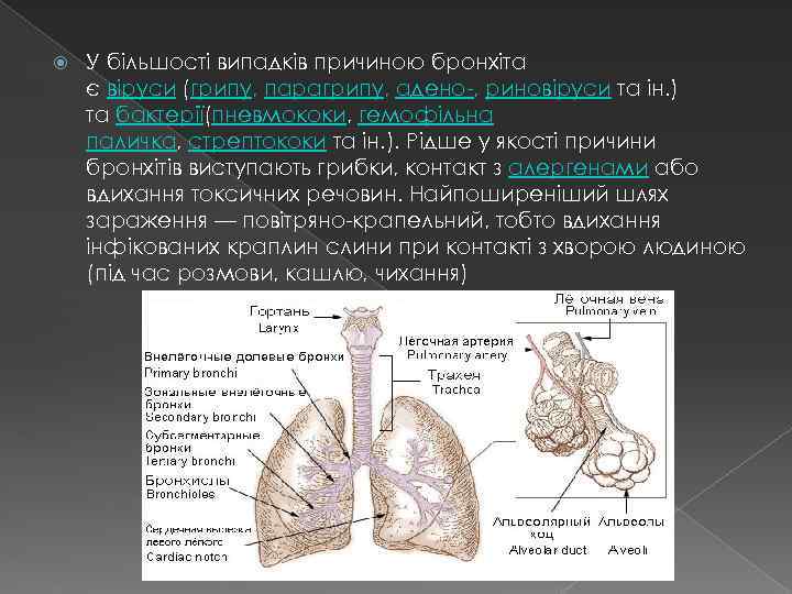  У більшості випадків причиною бронхіта є віруси (грипу, парагрипу, адено , риновіруси та