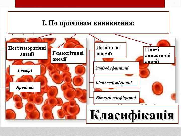 I. По причинам виникнення: Постгеморагічні анемії Гострі Хронічні Гемоклітинні анемії Дефіцитні анемії: Гіпо- і