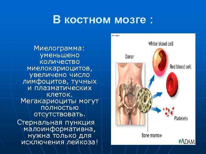 В костном мозге : Миелограмма: уменьшено количество миелокариоцитов, увеличено число лимфоцитов, тучных и плазматических