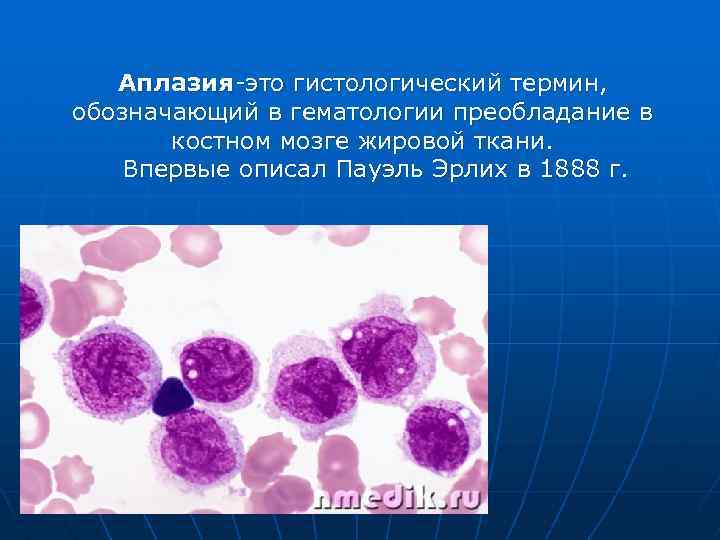 Аплазия-это гистологический термин, обозначающий в гематологии преобладание в костном мозге жировой ткани. Впервые описал