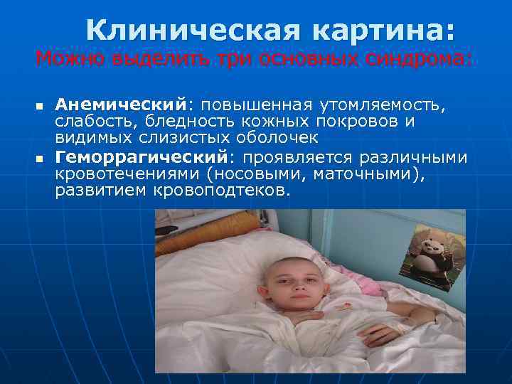 Клиническая картина: Можно выделить три основных синдрома: n n Анемический: повышенная утомляемость, слабость, бледность