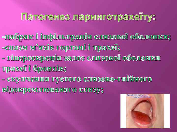 Патогенез ларинготрахеїту: -набряк і інфільтрація слизової оболонки; -спазм м'язів гортані і трахеї; - гіперсекреція