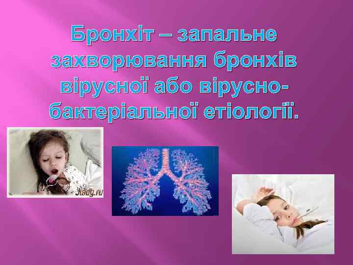 Бронхіт – запальне захворювання бронхів вірусної або віруснобактеріальної етіології. 