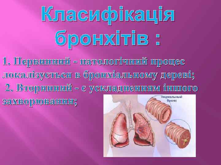 Класифікація бронхітів : 1. Первинний - патологічний процес локалізується в бронхіальному дереві; 2. Вторинний