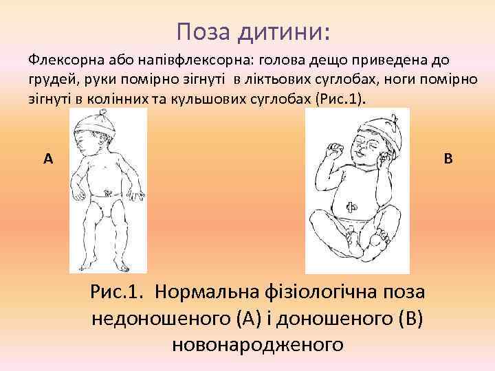 Поза дитини: Флексорна або напівфлексорна: голова дещо приведена до грудей, руки помірно зігнуті в