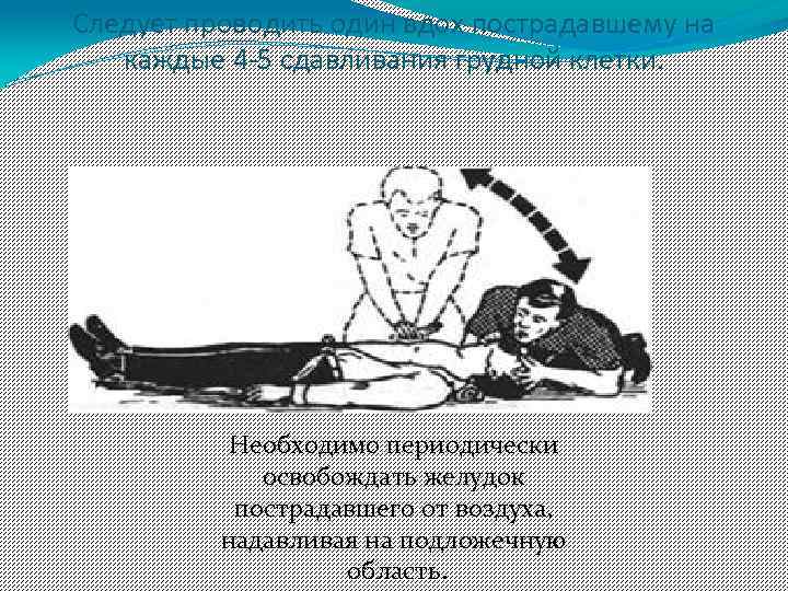 Следует проводить один вдох пострадавшему на каждые 4 -5 сдавливания грудной клетки. Необходимо периодически