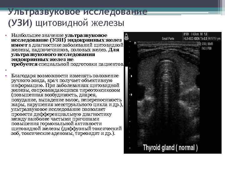 Диагноз желез. УЗИ щитовидной железы методика исследования. Ультразвуковые методы исследования щитовидной железы. УЗИ эндокринной железы. Датчик для УЗИ щитовидной железы.