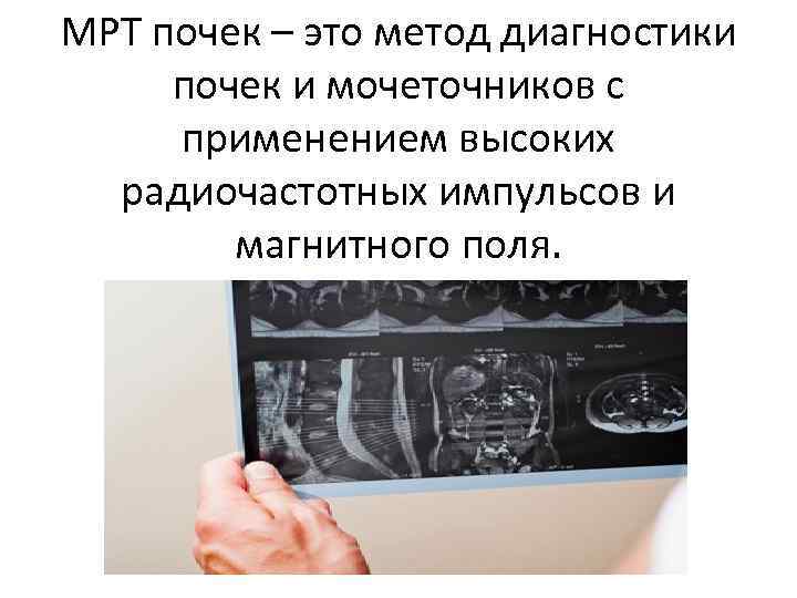 МРТ почек – это метод диагностики почек и мочеточников с применением высоких радиочастотных импульсов