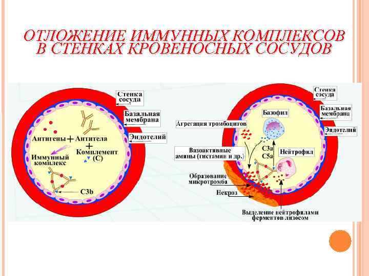 ОТЛОЖЕНИЕ ИММУННЫХ КОМПЛЕКСОВ В СТЕНКАХ КРОВЕНОСНЫХ СОСУДОВ 