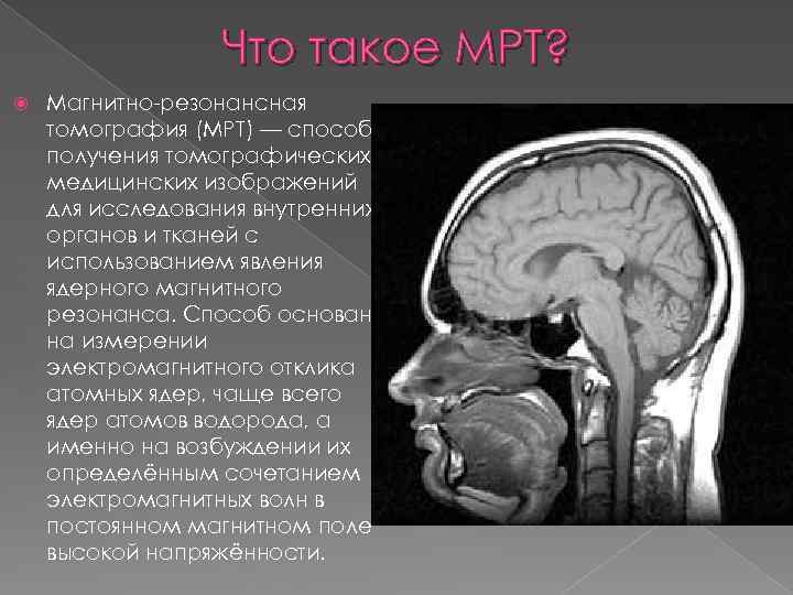 Что такое МРТ? Магнитно-резонансная томография (МРТ) — способ получения томографических медицинских изображений для исследования