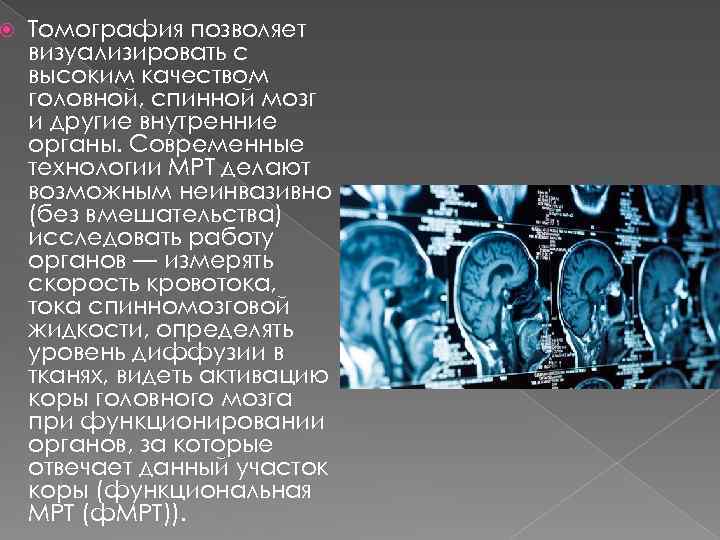  Томография позволяет визуализировать с высоким качеством головной, спинной мозг и другие внутренние органы.