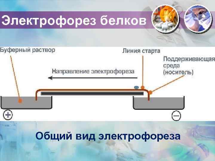 Электрофорез белков Общий вид электрофореза 