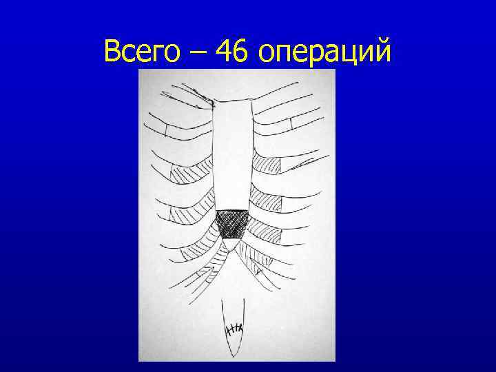 Всего – 46 операций 