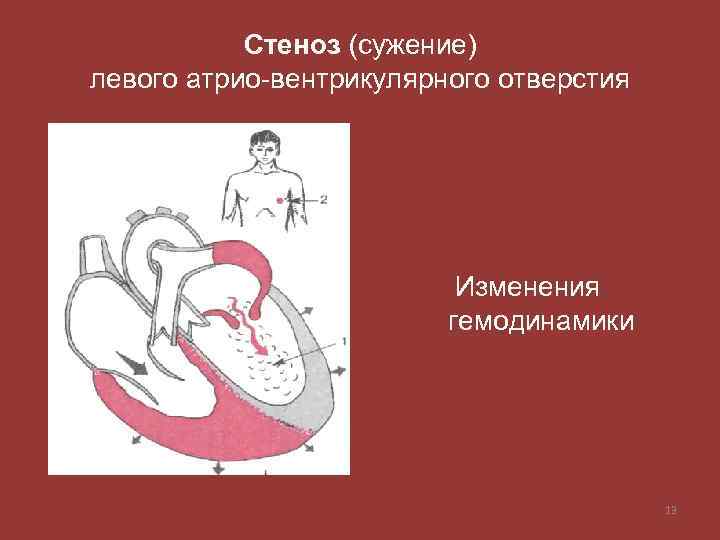 Рисунок клапанный аппарат сердца