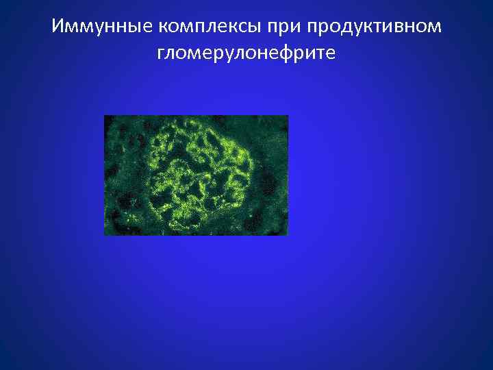 Иммунные комплексы при продуктивном гломерулонефрите 