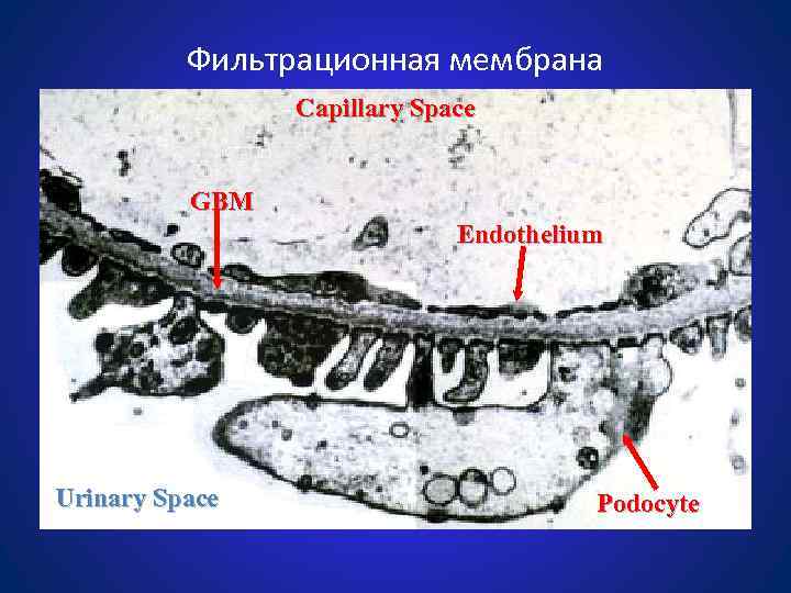 Фильтрационная мембрана Capillary Space GBM Endothelium Urinary Space Podocyte 