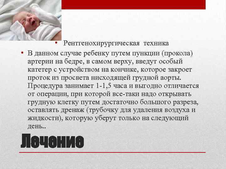  • Рентгенохирургическая техника • В данном случае ребенку путем пункции (прокола) артерии на