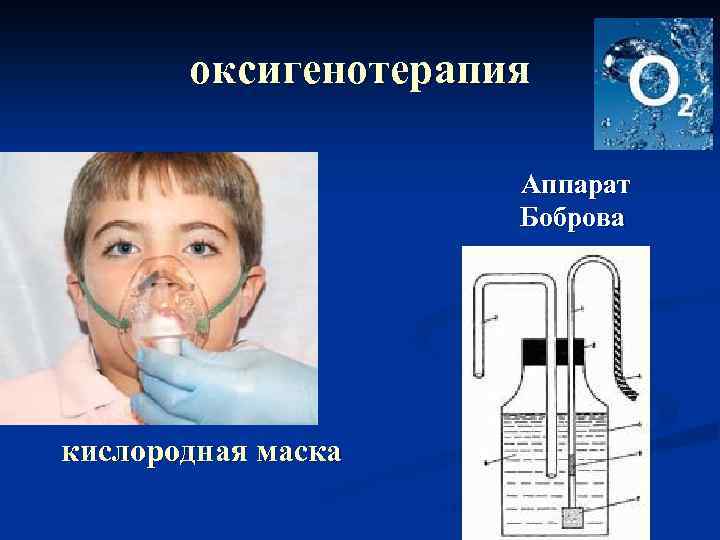 оксигенотерапия Аппарат Боброва кислородная маска 