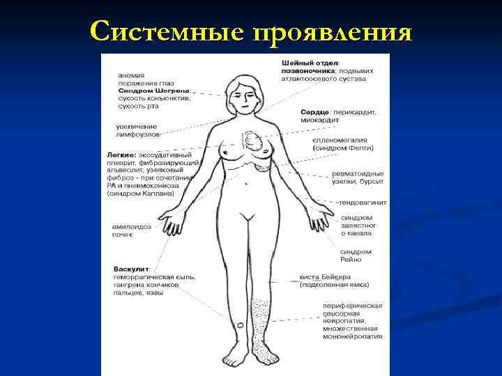 Системные проявления 