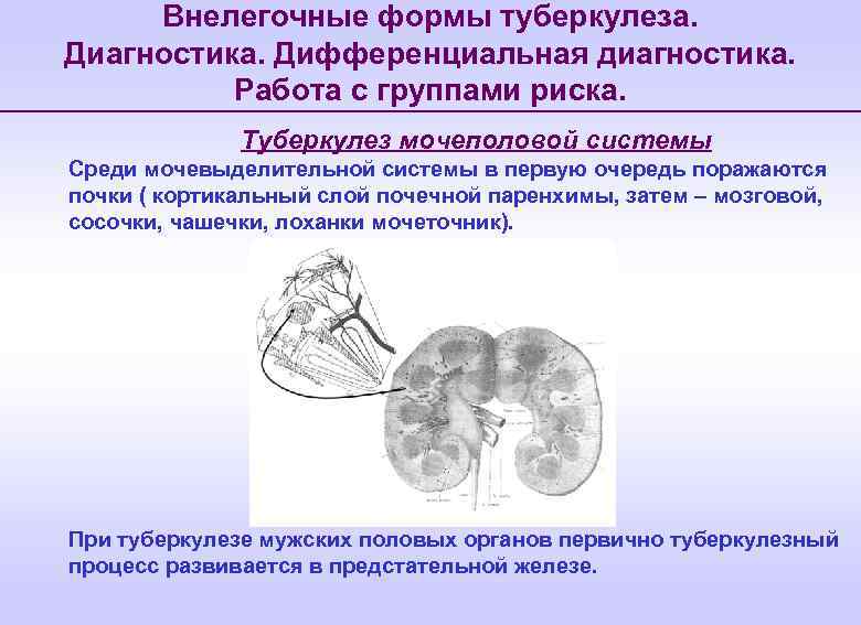 Сайт фтизиатрии