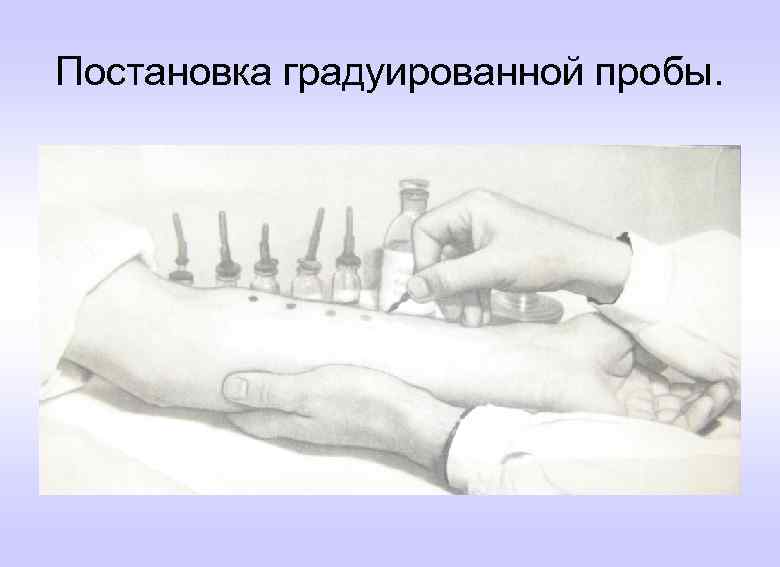 Постановка градуированной пробы. 