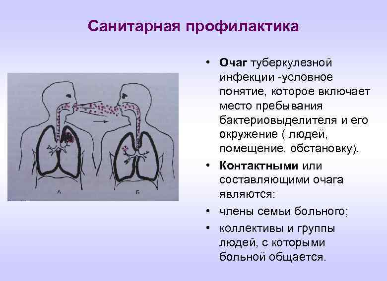 Санитарная профилактика • Очаг туберкулезной инфекции -условное понятие, которое включает место пребывания бактериовыделителя и
